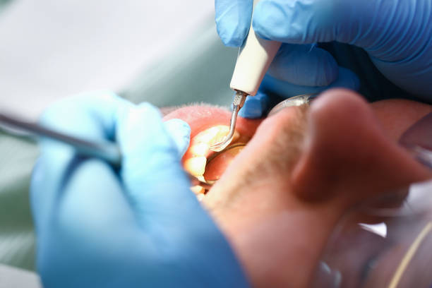 Best Orthodontic Emergency Dentist in Goodman, MS