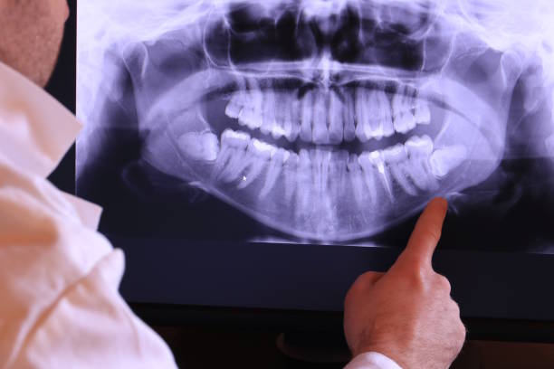 Best Emergency Dentist for Special Needs Patients in Goodman, MS