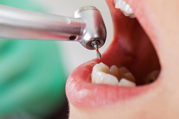 Best Emergency Dental Services for Seniors in Goodman, MS
